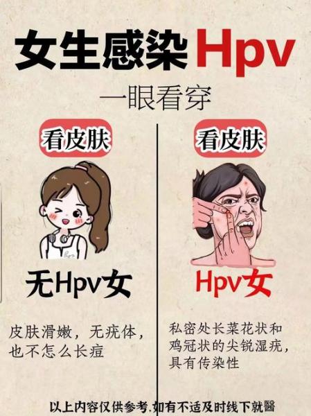 感染hpv有症状吗