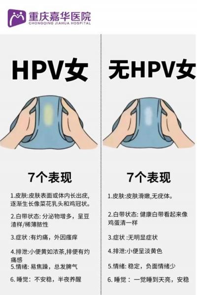 如何判断是否有HPV